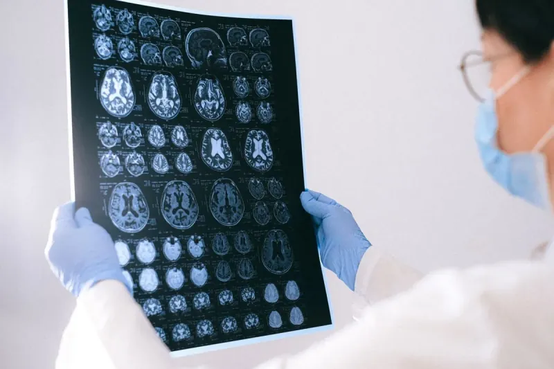 The FDA Approves The First Commercial Implanted Brain-computer Interface For Motor Function Restoration (Synchron Stentrode Or Neuralink N1).