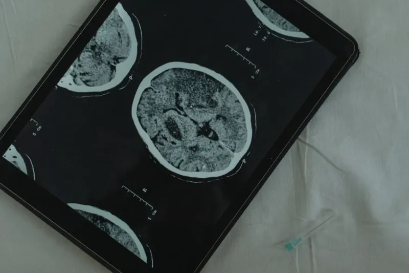 The Global Brain-computer Interface Market Reaches $5.5 To $7 Billion By 2030, With The Medical Implantable Segment Growing Fastest At 20-25 Percent Annually. The Global Brain-computer Interface Market Reaches $5.5 To $7 Billion By 2030, With The Medical Implantable Segment Growing Fastest At 20-25 Percent Annually.