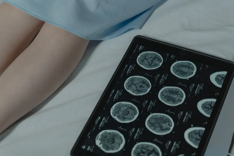 At Least One Brain-computer Interface (BCI) Implant Is Expected To Receive Commercial Marketing Approval In The US By 2029 For Patients With Paralysis Or Speech Impairment. At Least One Brain-computer Interface (BCI) Implant Is Expected To Receive Commercial Marketing Approval In The US By 2029 For Patients With Paralysis Or Speech Impairment.